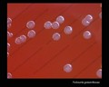 neisseria gonorrhoeae